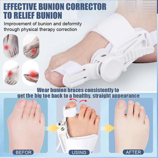 Adjustable Toe Corrector Unisex Bunion Foot Hallux Valgus Braces Rotatable Toe Separator Straightener for Left and Right Foot