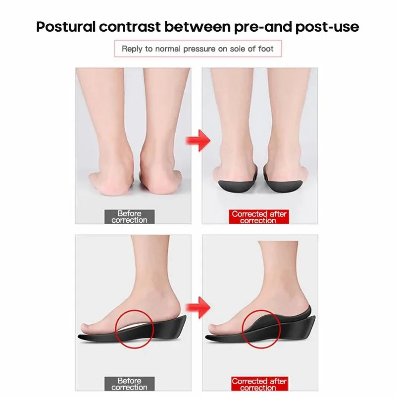 1 Pair Arch Support Inserts - Comfortable TPR Material, Ideal for Men & Women, Universal Fit, Promotes Proper Foot Alignment